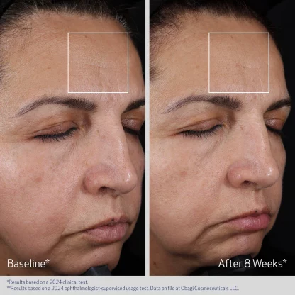 Obagi ELASTIderm Advanced Filler Concentrate 20ml
