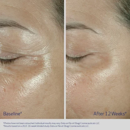 Obagi ELASTIderm Eye Cream 15g